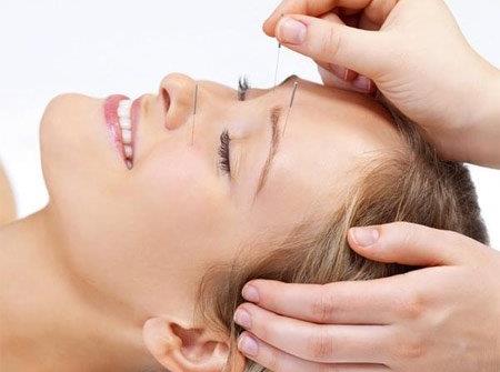 針灸美容效果好嗎?針灸美容的功效