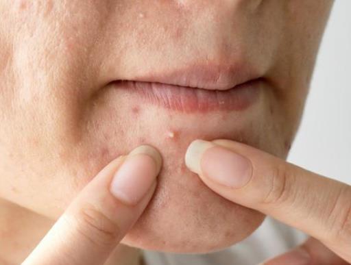 為什么敷什么面膜都會過敏?面膜過敏有哪些癥狀?