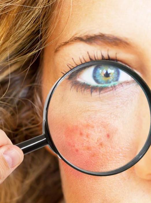 為什么敷什么面膜都會過敏?面膜過敏有哪些癥狀?