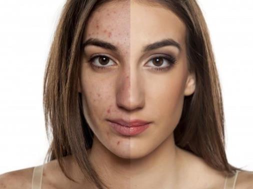 為什么敷什么面膜都會過敏?面膜過敏有哪些癥狀?