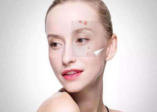 怎么去黑頭才不會(huì)擴(kuò)大毛孔?怎么去鼻子上的黑頭?