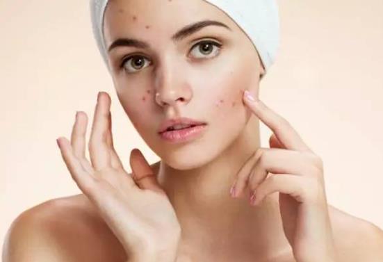 怎么去黑頭才不會(huì)擴(kuò)大毛孔?怎么去鼻子上的黑頭?