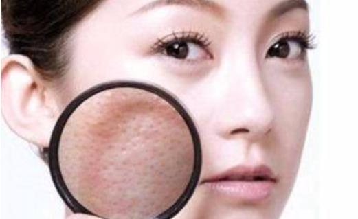 毛孔粗大用食鹽有用嗎 毛孔粗大敷什么面膜好