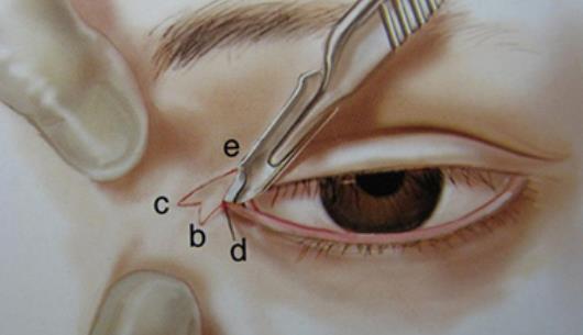 �_�۽����g��ʲô���� ʲô�ӵ���Ⱥ�m���_�۽����g