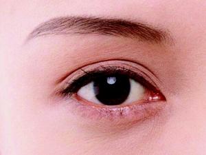 怎樣讓眼睛自然變大?什么是小眼癥矯正