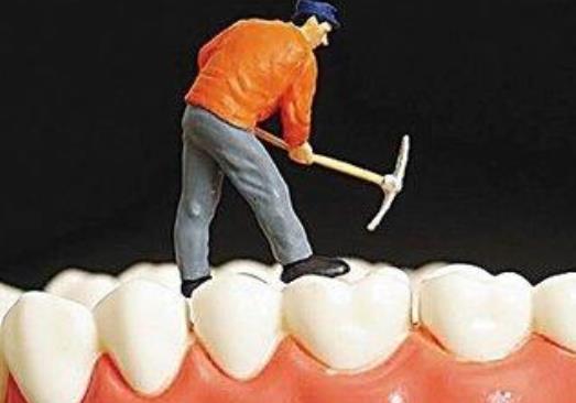 牙結(jié)石可以自己扣掉嗎?牙結(jié)石怎么才可除去?