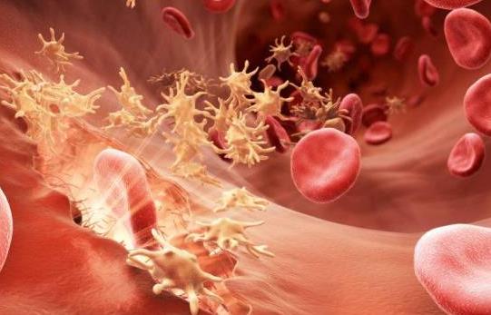 Ѫ�Ѳ����z���᣿Ѫ�Ѳ����ڕ����Fʲô�Y��