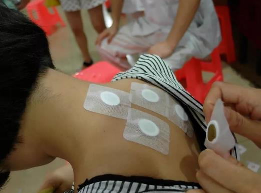 貼完三伏貼的第二天能同房嗎?三伏貼和艾灸能一起做嗎