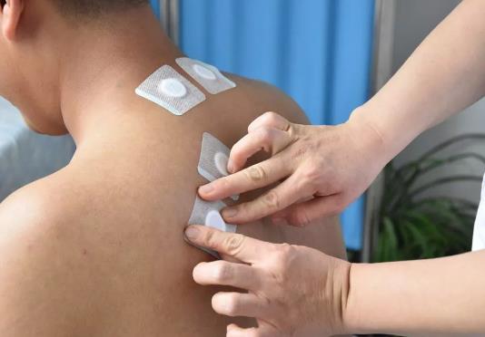 貼完三伏貼的第二天能同房嗎?三伏貼和艾灸能一起做嗎