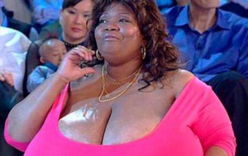 世界上最大的天然乳房 安妮·霍金斯·特納雙乳重達38.5公斤