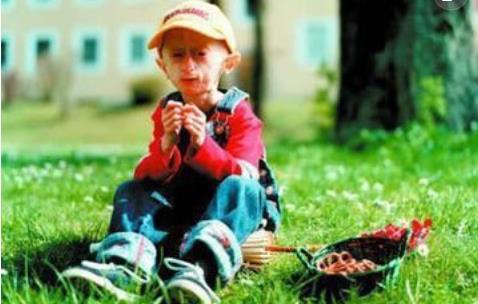 世界上最老的孩子 塞斯·庫克12歲的年紀90歲的面容