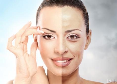 如何治療各種色斑?各類色斑的治療方法