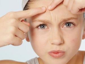 臉上長痘痘怎么調理?臉上長痘痘切忌不能做五件事