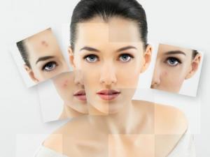 美白祛斑誤區(qū):愛美女性必知的祛斑四誤區(qū)