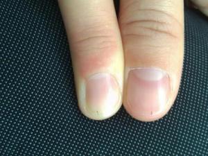 ��ָ���^���� ����ָ�������Q�y��(y��ng)ע���{(di��o)��