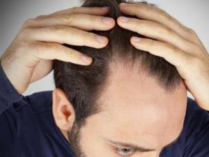 ��������Ó�l(f��)��ô�k����ʲôʳ�����A(y��)��Ó�l(f��)