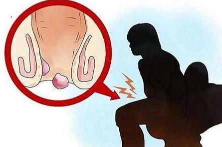 女性痔瘡真人實(shí)拍圖片 網(wǎng)上曝光的7個小偏方有效治痔瘡