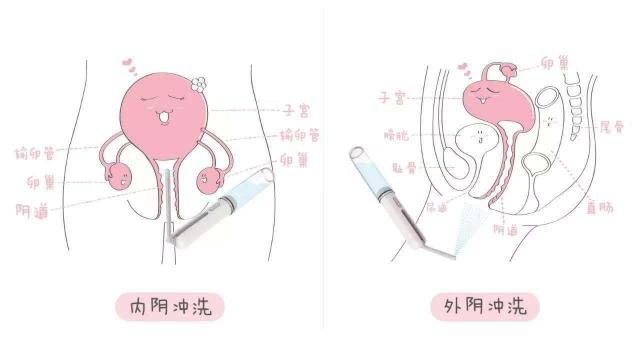 女人陰道是什么樣子的圖片科普 陰部真實構造解剖結構圖