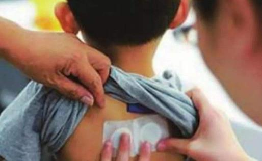 三九貼可以自己在家貼嗎 三九貼貼哪些部位