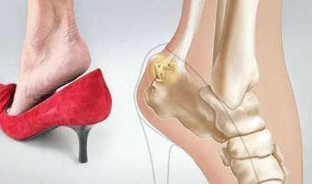 鞋子磨腳怎么辦?鞋子小了磨腳怎么辦?