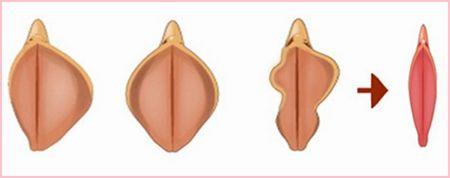 木耳黑是什么意思?為什么說女人黑木耳?粉木耳為什么會變黑木耳