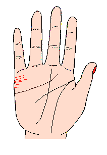 結合線很短又不規則，而且很多條