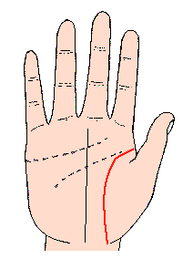 生命線圖解：生命線之弧形少