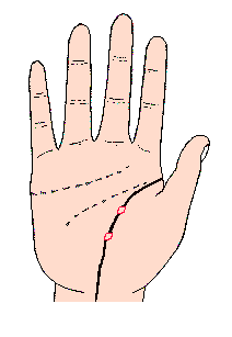 生命線的中途，出現島形記號