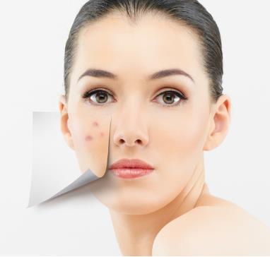 臉上長痘痘是什么原因？臉上長痘痘怎么調(diào)理？青春痘怎么消除