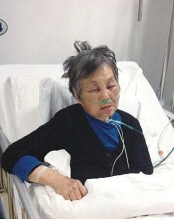 教授醉酒耍酒瘋殘忍毆打7旬老人令人發指，被打老人昏迷大小便失禁