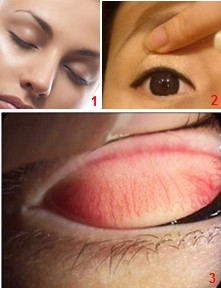 眼睛里進東西怎么辦?眼睛進異物怎么辦