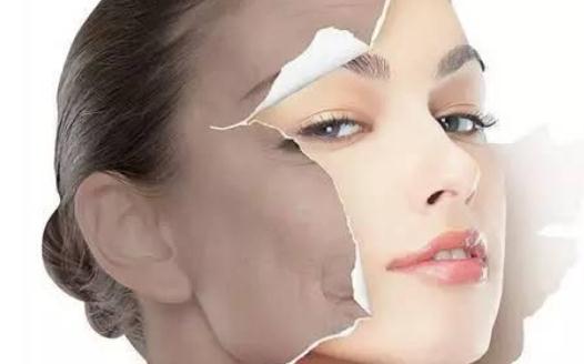 怎么才能祛斑?為什么會長斑?