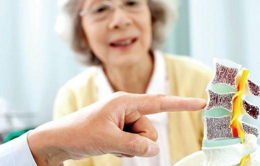 治療骨質疏松癥不是單純的補鈣 治療的辦法有哪些