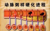 什么是“動粥”？哪些是“動粥疾病”高危人群？