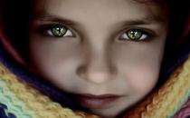 銷魂媚眼 雙眼皮切法詳解