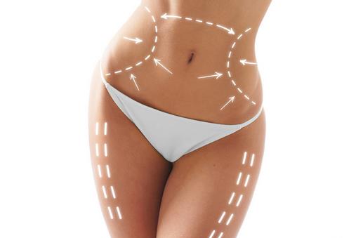 女性必知:吸脂減肥的副作用