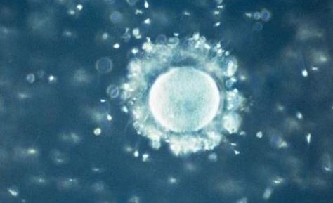 女人如何提高卵子質(zhì)量