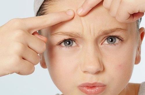 青少年痤瘡的有效預(yù)防方法