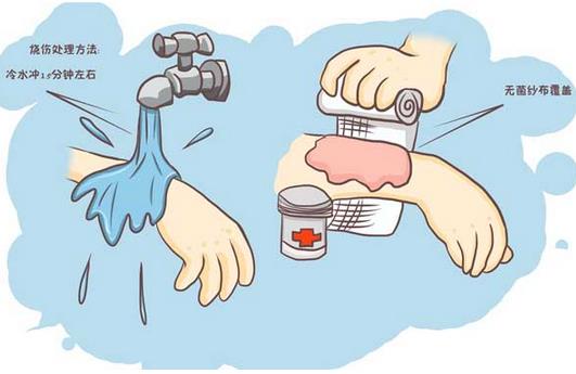 如何處理燒燙傷后起的水泡？