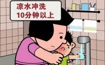 被開水燙傷怎么辦？應急措施介紹