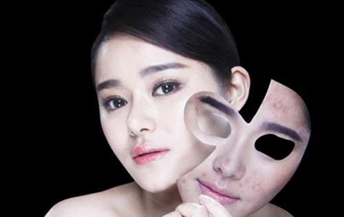 七個小竅門幫你戰勝痘痘