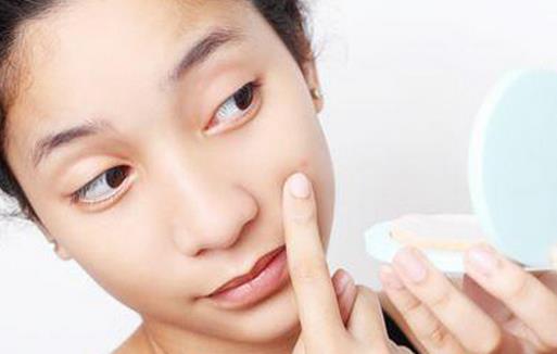 女孩兒必知的“戰痘”秘籍