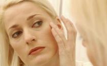 4招預防魚尾紋 恢復年輕美麗