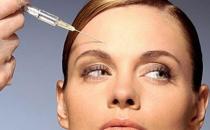 哪些除皺術讓你告別抬頭紋