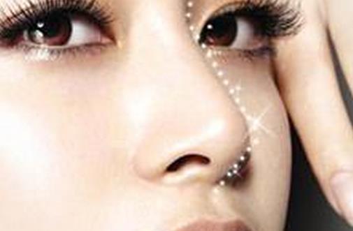 鼻部整形失敗表現及鼻部整形修復