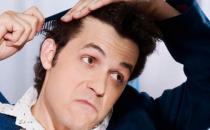 中年男性脫發怎么辦？