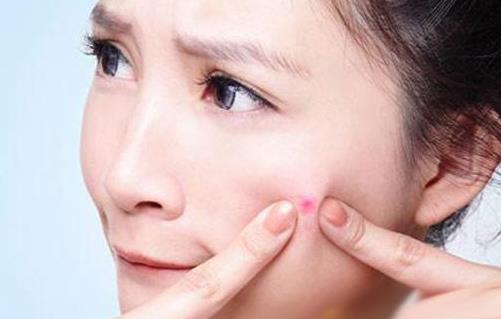 臉上各種“粉刺”的區別和應對方法