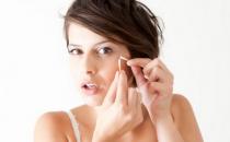 激光祛痘 要認(rèn)清痘痘類型