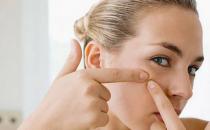 長痘啥原因？痘痘長成大剖析！