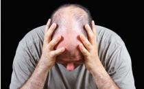 脫發男必看！防脫只需五招